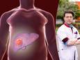 Le Dr Timon Vandamme est spécialiste en oncologie digestive à l’UZA.
