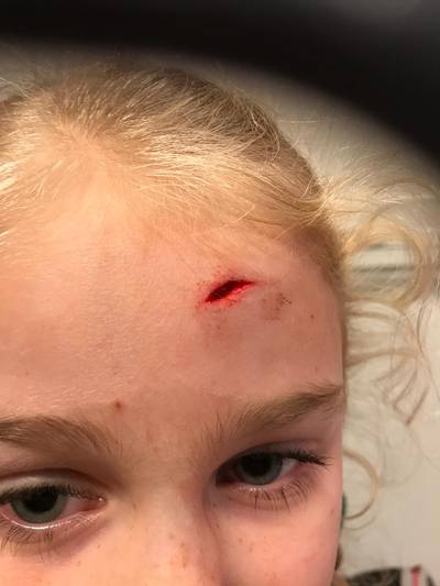 Feline (7) gewond door roekeloze scooter: ‘Dit is te bizar voor woorden’