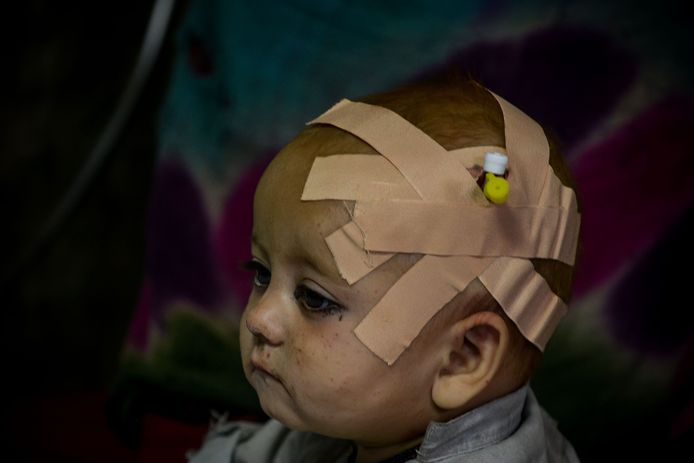 Een Afghaans kind kreeg de eerste zorgen in het ziekenhuis van Sharan