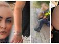 Sharon Schevers uit Nijmegen werd aangehouden door de politie. Op de foto's laat ze blauwe plekken zien die ze daarbij opliep.