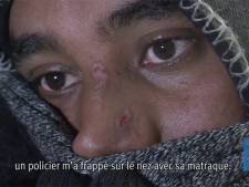 La police française accusée de maltraiter les migrants à Calais