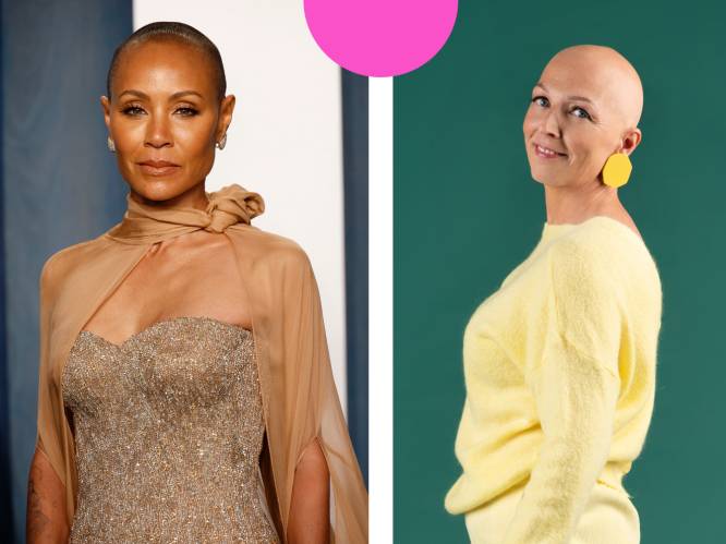 De ziekte die Jada Pinkett-Smith kaal maakt trof ook Mieke. “Niemand maakt er meer grappen over dan ik”