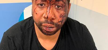 Macron wil effectievere bestrijding discriminatie door politie na ‘beschamend’ geweld tegen zwarte man  