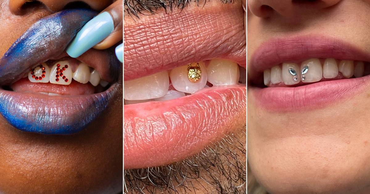 Tooth Jewelry: The Rising Trend Among Generation Z