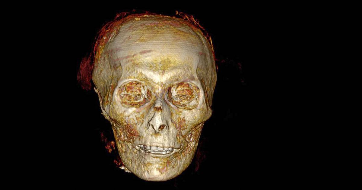 La mummia “esaurita” dell’antico Egitto svela i suoi segreti |  Scienza