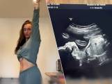 Lily (21) merkt pas na zes (!) maanden dat ze zwanger is