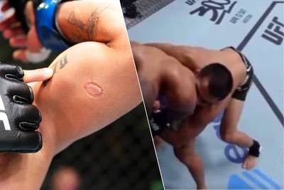 Beet in arm betekent einde van UFC-carrière voor Braziliaanse kooivechter, tegenstander laat afdruk prompt tatoeëren
