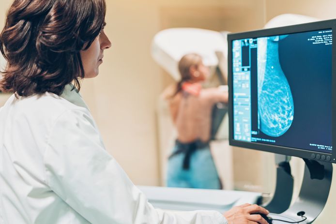Illustratiebeeld mammografie.