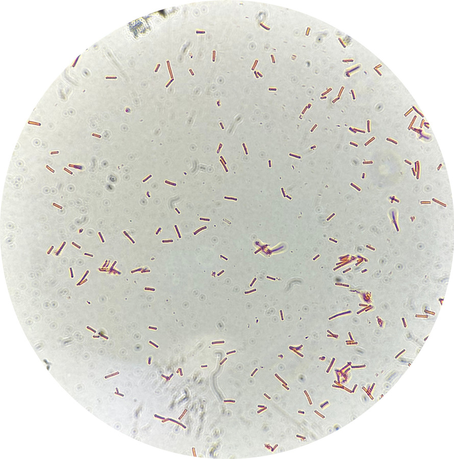 Gezocht in Eindhoven vrouwen die eigen vaginale bacteriën op kweek zetten om andere vrouwen te