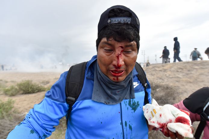 Een gewonde demonstrant tijdens protesten in de stad Arequipa te Peru. (19/01/23)