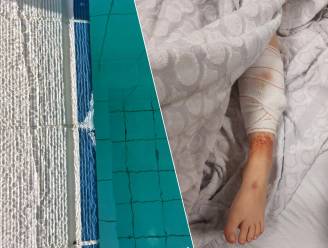 Meisje (9) loopt “horrorwonde” op in zwembad van Ieper: “De verpleger zag dat het bot zichtbaar was”