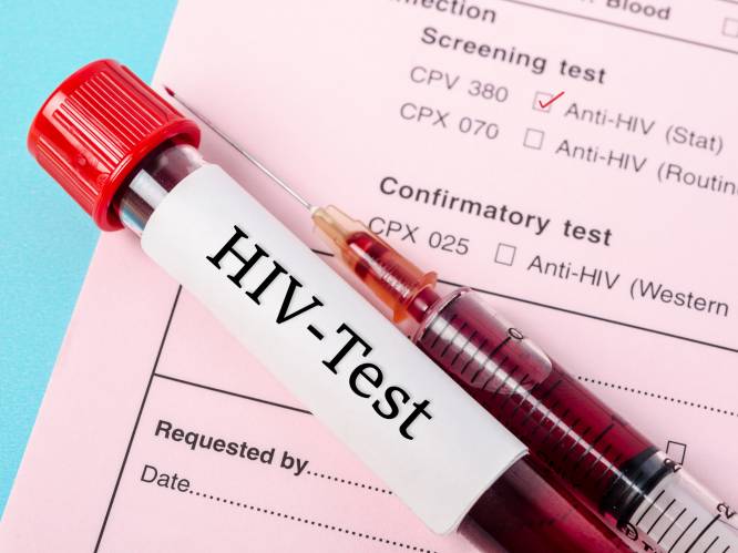 Wetenschappers ontdekken nieuwe en zeldzame variant hiv
