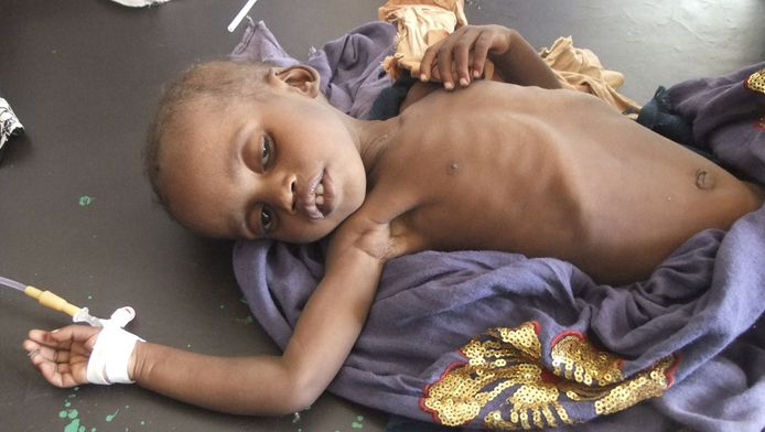 Maigres Dons Pour La Famine En Afrique Monde 7sur7 Be