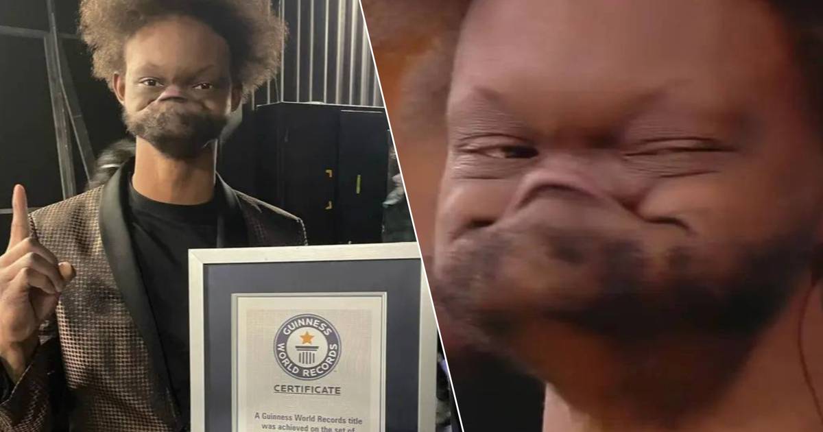 Jovante Carter Breaks World Record for Longest ‘Gurning’ by Stretching his Lower Lip Over his Nose