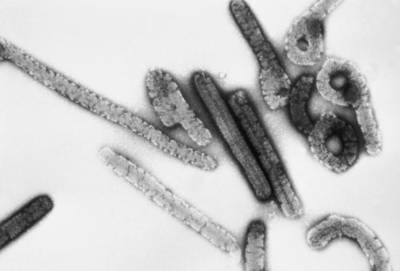 Voor het eerst geval van marburgvirus vastgesteld in West-Afrika