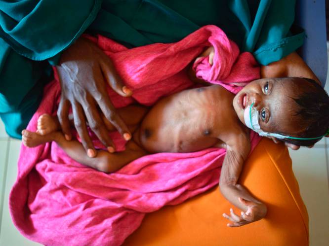 1,4 miljoen kinderen in Somalië bedreigd door acute ondervoeding