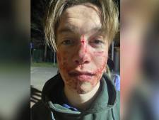 Daaf (19) ziet belagers na mishandeling op Paaspop terug in de rechtbank: ‘Helse pijn en angst’