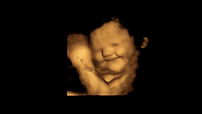 Foetus reageert met een 'lachend gezicht' op de smaak van wortel.