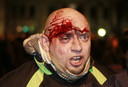 Un Ukrainien blessé au cours des manifestations