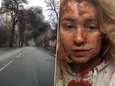 Harde beelden: bebloede scholier stuurt video naar vrienden na luchtaanval op schoolgebouw in Chernihiv