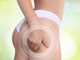 Ce que les hommes pensent vraiment de la cellulite