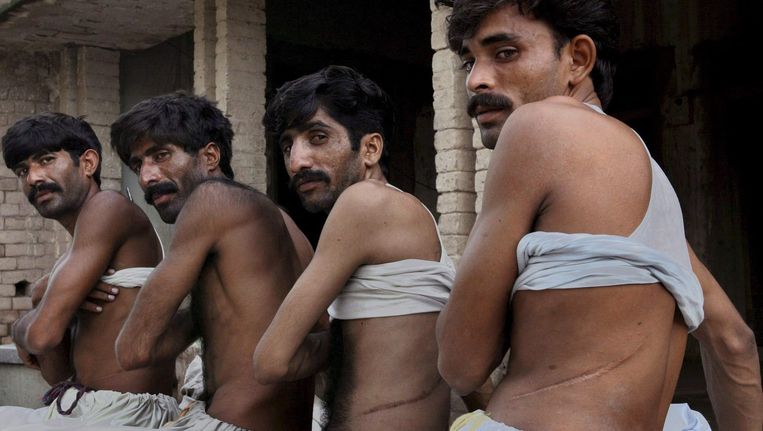 Archiefbeeld: Pakistaanse mannen tonen littekens na de verkoop van hun nieren. Orgaanhandel is illegaal in India en Pakistan. Beeld epa