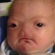 Facebook verwijdert foto van pasgeboren baby zonder neus