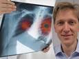 Prof. dr. Christophe Dooms legt onder meer uit wat longkanker is en hoe je het kan voorkomen.