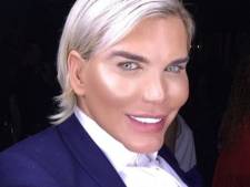 Faceliftfreak Rodrigo Baalt Van Laten Verwijderen Vier Zwevende Ribben Bizar Ad Nl