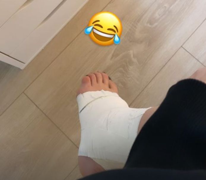 Davina Michelle zit nu met haar enkel in het verband.