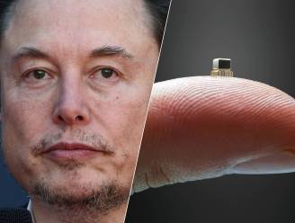 Elon Musk meldt doorbraak met hersenchip: computermuis besturen met je gedachten