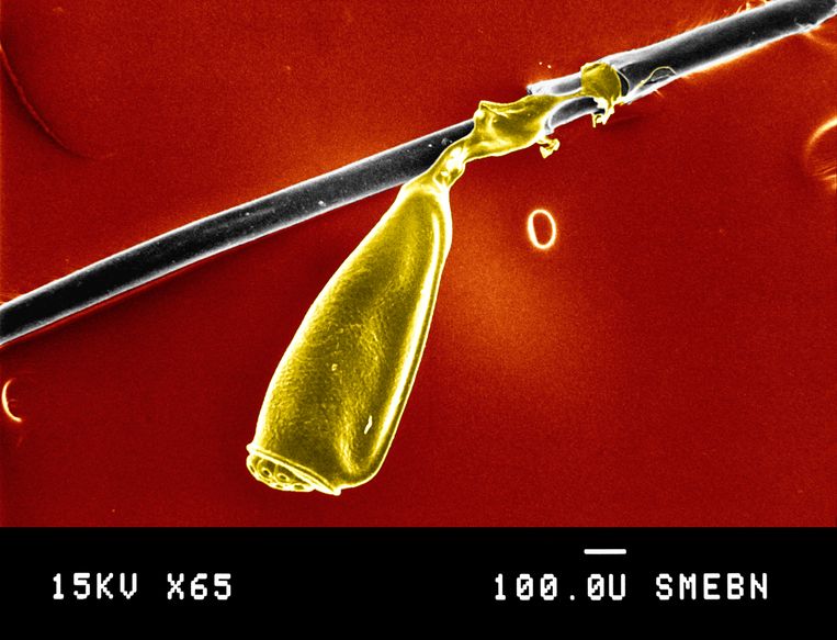 Een opname gemaakt met een elektronenmicroscoop van een neet aan een mensenhaar. De lijm waarmee luizen hun eieren aan haren plakken, blijkt bijzonder goed het menselijk dna in het haar te conserveren. Beeld Universal Images Group via Getty