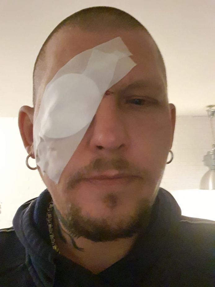 Brian Tas (41) uit Alphen raakte gewond aan zijn oog en gezicht toen hij op de scooter tegen een visdraard reed dat over de weg was gespannen