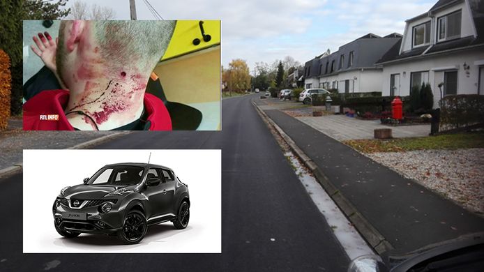 Sébastien Delvenne (21) was vorige week aan het joggen in de Rue des Près te Borgworm, toen hij beschoten werd met een loodjeskarabijn. De twee daders reden in een donkerkleurige Nissan, waarschijnlijk van het type Juke. De politie is naar hen op zoek.