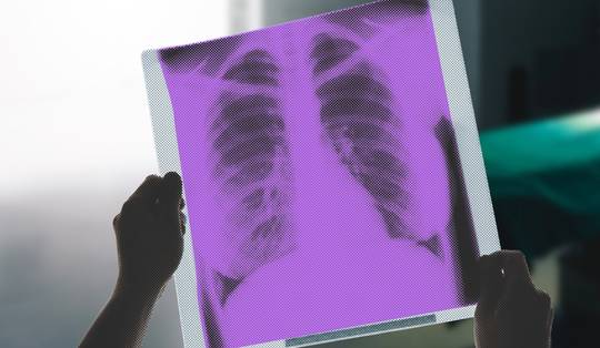 ‘Wat niet oké is, is dat een aantal collega’s excessief betaald wordt voor hetzelfde of zelfs minder uren werk’: hoog- en laagverdieners onder de dokters reageren