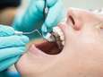 Tot 1.050 euro teruggave voor een tandprothese: deze mutualiteit betaalt het meeste van je tandarts- en orthodontiekosten terug