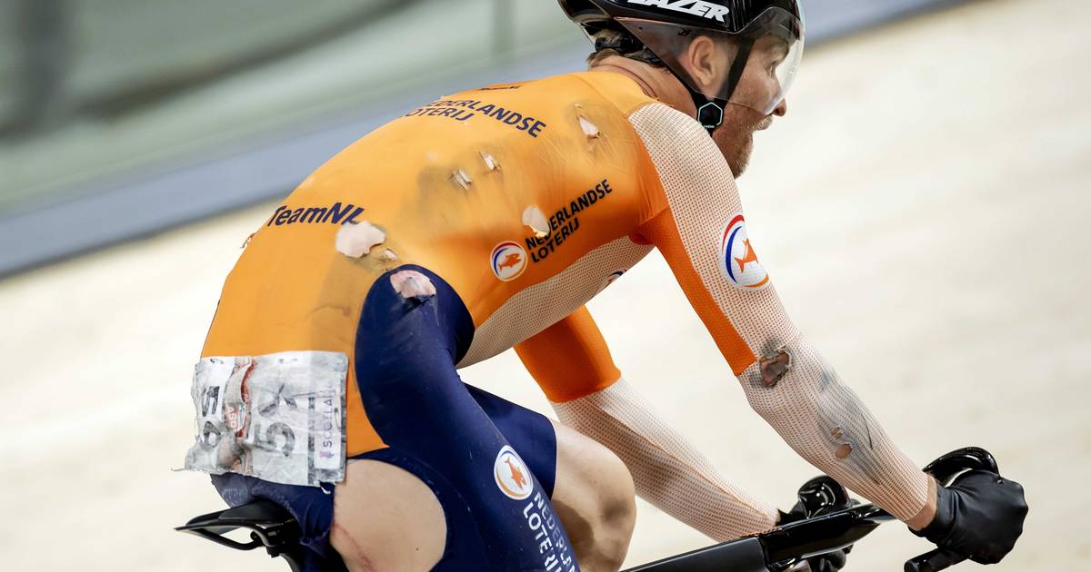 Matthijs Büchli rijdt met sleutelbeen uit de kom afvalrace uit: ‘Ik ...