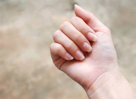 Witte vlekjes op je nagels? Dít kunnen de oorzaken zijn