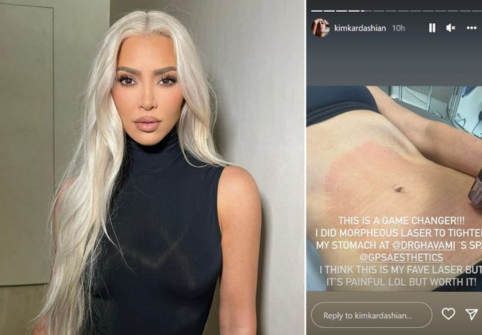Ontharen Met Ipl Of Laser? Wat Is Beter? - Laserontharing Prijs - socleanclinic.be +32 89 21 93 43 thumbnail