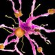 Totaal nieuw alzheimermedicijn goedgekeurd in VS, niet alle experts staan te juichen