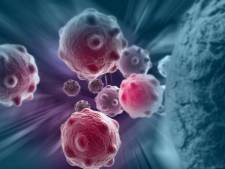 Un virus “tueur de cancer” issu de la variole testé sur un premier patient
