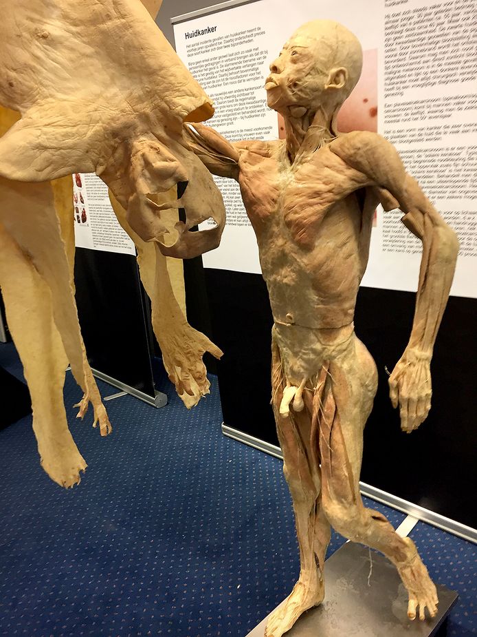 De rondreizende expositie Real Human Bodies was vorig jaar in Breda te zien.