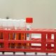 Nederlands bedrijf verkocht 1,5 miljoen onbetrouwbare coronatests