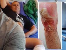 Poolse Marcin (44) viel in kokend vet tijdens werk in Dronten, maar had geen zorgpas: ‘Ik voelde meteen dat het heel erg was’