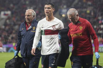 Pijnlijk! Cristiano Ronaldo bloedt hevig na contact met de vuisten van Tsjechische doelman