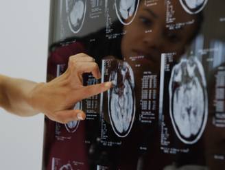 Wetenschappers ontdekken dat brein van ex-coronapatiënten is gekrompen