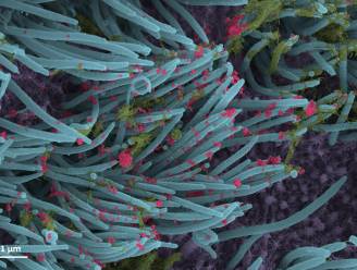 Wetenschappers publiceren gedetailleerde beelden van het coronavirus in actie