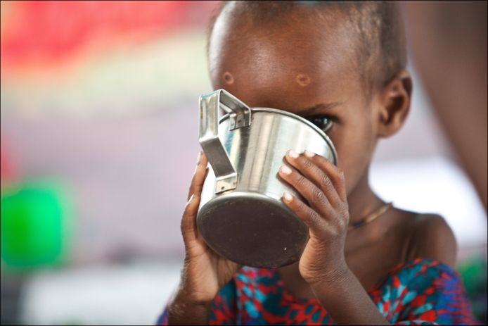 Naar schatting 45 miljoen kinderen hadden in 2020 te maken met levensbedreigend ondergewicht.