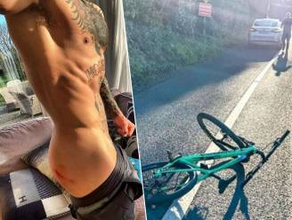 Conor McGregor overleeft aanrijding op de fiets: “Dankzij ervaring als vechter wist ik hoe te vallen”