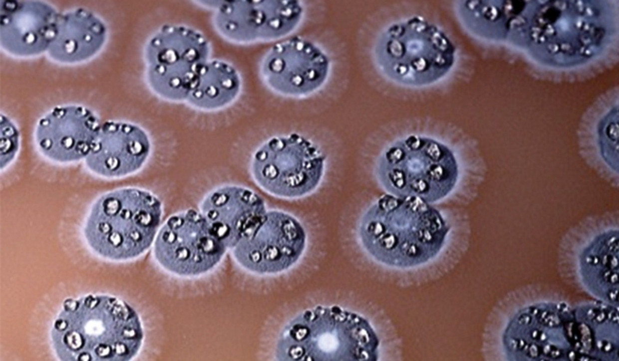 De bacterie streptomyces ambofaciens, die geosmine produceert. Beeld -
